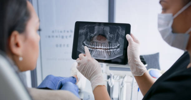Licensed Dental Implants service in Towson, MD - Smile Center Dentistry