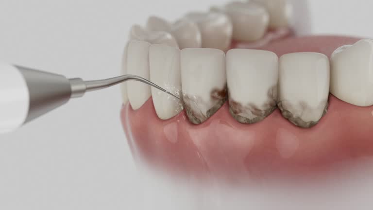 Reliable Dental Implants contractor in Towson, MD by Smile Center Dentistry